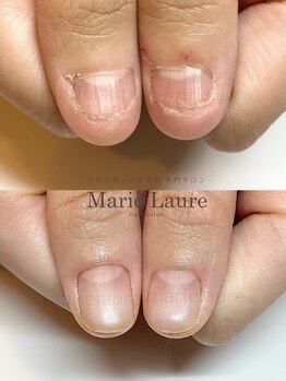 マリーロール 梅田店(Marie Laure)/深爪改善/自爪育成/ネイルケア/