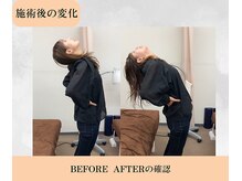 たけだ整体院 鍼灸院/施術後の変化