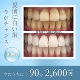 ホワイトニングショップ 出雲店