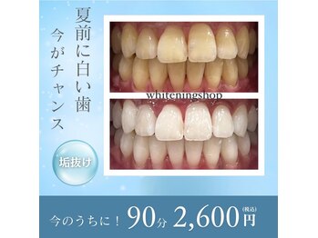 ホワイトニングショップ 出雲店