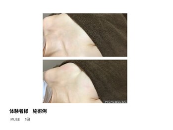 アップオー 天神大名店(up O)/