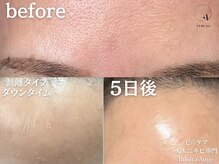 ボニータアンジュ 恵比寿(Bonita Ange)の雰囲気（長野県のハーブ博士が育てる無農薬ハーブ＋漢方ピーリングで施術）