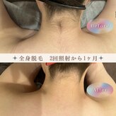 モアトゥインクル 山口店(MORE twinkle)