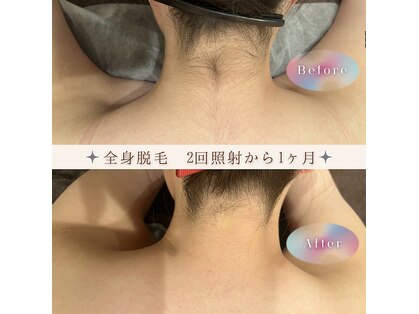 モアトゥインクル 山口店(MORE twinkle)の写真