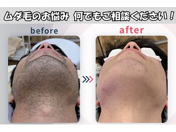 ネクストプラス 梅田店(NEXT+)