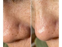 サイ(Sai)/before⇒after