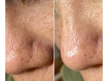 サイ(Sai)/before⇒after