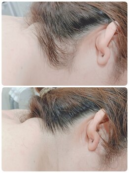 エタニティ 西宮店(Eternity)/うなじ、背中/成人式/ブライダル