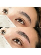 ブルーモ(Bloomo)/Before After［眉毛］