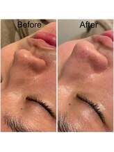 ドクターエイチ 麻布十番店(Doctor.H)/