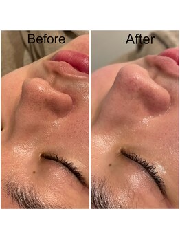 ドクターエイチ 麻布十番店(Doctor.H)/