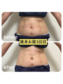 ルクール(Le Couer)/５０代痩身３回の効果