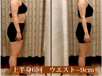 サロン セドナ(SALON SEDONA)/上半身リンパ痩身 6回コース