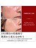 ≪細胞レベル再生≫究極の幹細胞上清培養液＋フェイシャルエステ48000→33000