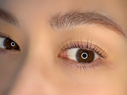 Rinett eye designの写真