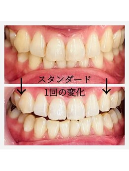 シエル(CIEL)/ビフォーアフター