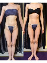 アスエ(ASUE)/エンダモロジー＋サーモシェイプ