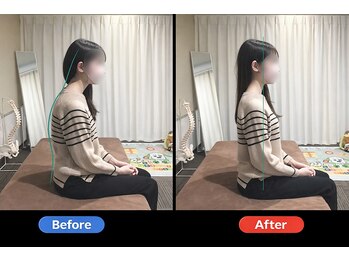 鹿児島整体院の写真/猫背・歪み改善は実績豊富な姿勢の専門家にお任せ◎AI姿勢分析×骨格矯正で見た目と不調を根本改善！