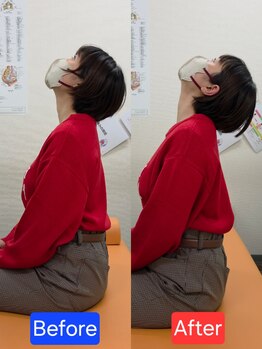 最後の整体 練馬駅前院/肩こりでお悩みの方の可動域