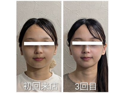 美容整体 ココ(COCO)の写真