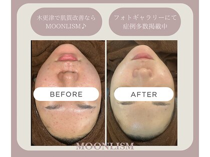ムーンリズム(Moonlism)の写真