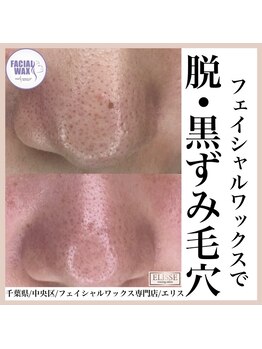 エリス(ELISSE)/脱・黒ずみ毛穴
