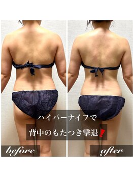 ラ マジ(La Magie)/