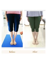 ストレッチヒーロー 倉敷中庄店/O脚レベルの変化