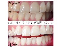 ソエル(Soeru)