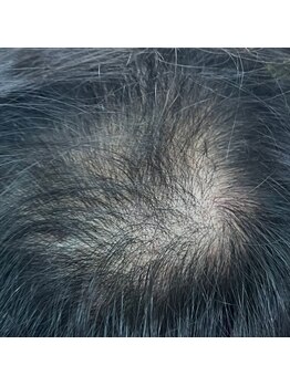 ル キヤ アイスペシャリテ ハービスENT店/再生美容アイブライトニング