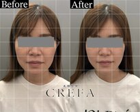 クレファ(CREFA)