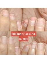 マニエネイル(mani e nail)/傷んでいる自爪の成長4ヶ月目
