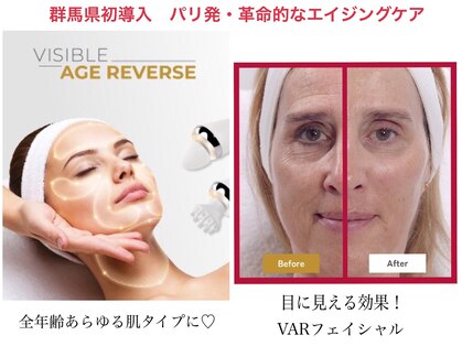リュミエールボーテの写真