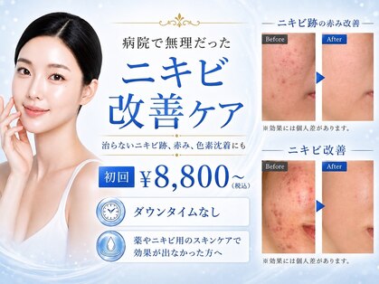 シャルナ(charna)の写真