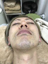 ナノハナ/鹿沼市の全身脱毛のナノハナ