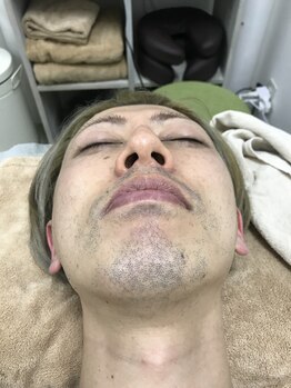 ナノハナ/鹿沼市の全身脱毛のナノハナ