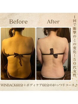 エソール(essor)/まるで別人!1回で驚きの変化◎