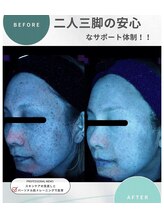 エーティーセンターラボ(At.center labo)/結果の出るしみプログラム