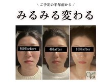 キュープ 松戸店(Qpu)