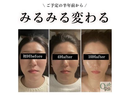 キュープ 松戸店(Qpu)の写真