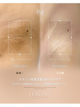 ミタス(Me+)/メラニンケア【ルメラ】ワキ