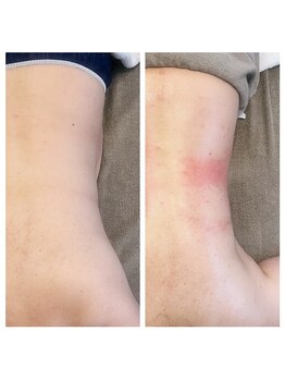 美温(mion)/腰回りライン出し