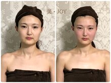 美 ジョイ(美 JOY)/小顔コルギ　施術例