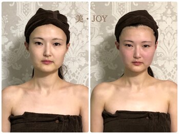 美 ジョイ(美 JOY)/小顔コルギ　施術例