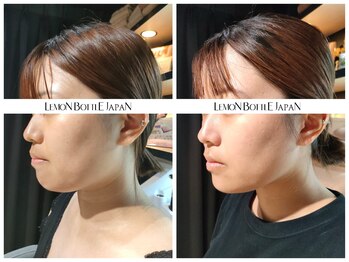 ホワイトラボ 梅田(White labo)/韓国肌管理専門店White labo梅田