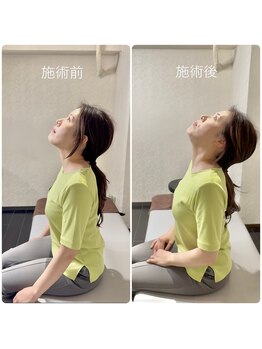 名古屋栄 肩こり腰痛専門整体 らーく/お客様のbefore、after