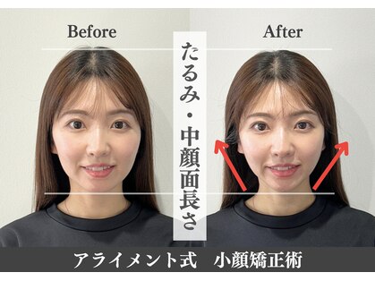 【整体・小顔矯正・姿勢矯正・骨盤矯正・肩甲骨・肩こり】整体 Alignment 恵比寿の写真