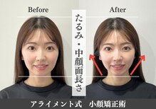 【整体・小顔矯正・姿勢矯正・骨盤矯正・肩甲骨・肩こり】整体 Alignment 恵比寿