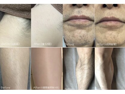 キャナ(CANA)の写真