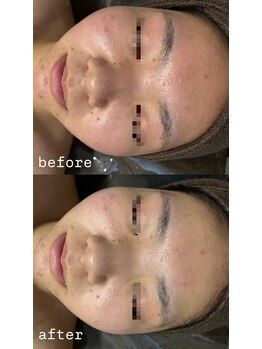 エクラ(ECLAT)/レストセルトリートメント